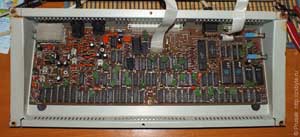 Поциент после реанимации